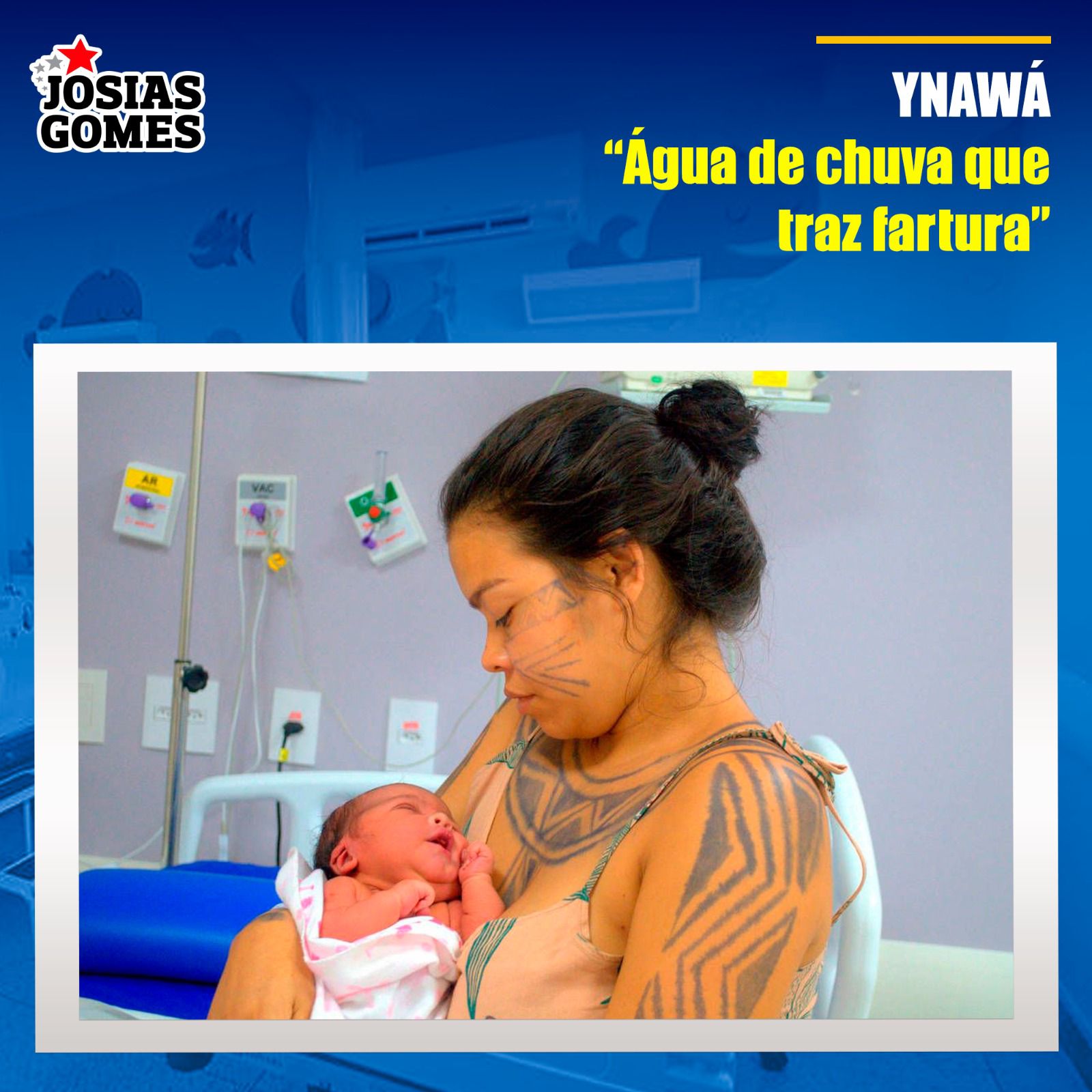 Hospital Materno Infantil Dr. Joaquim Sampaio Emociona O País Com Parto Humanizado Da Indígena Ynawá